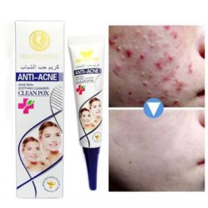 3 Days Clear Strong Acne Ointment
